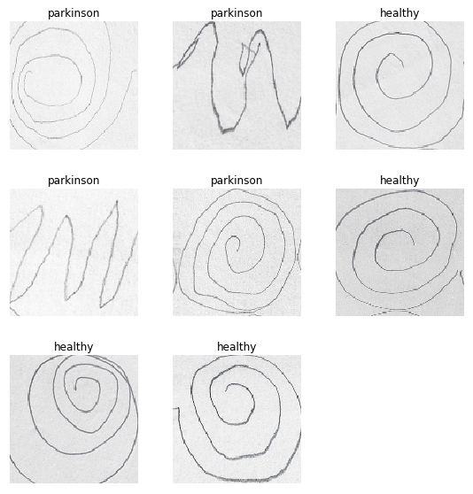 Parkinson-s-Disease-Classifier