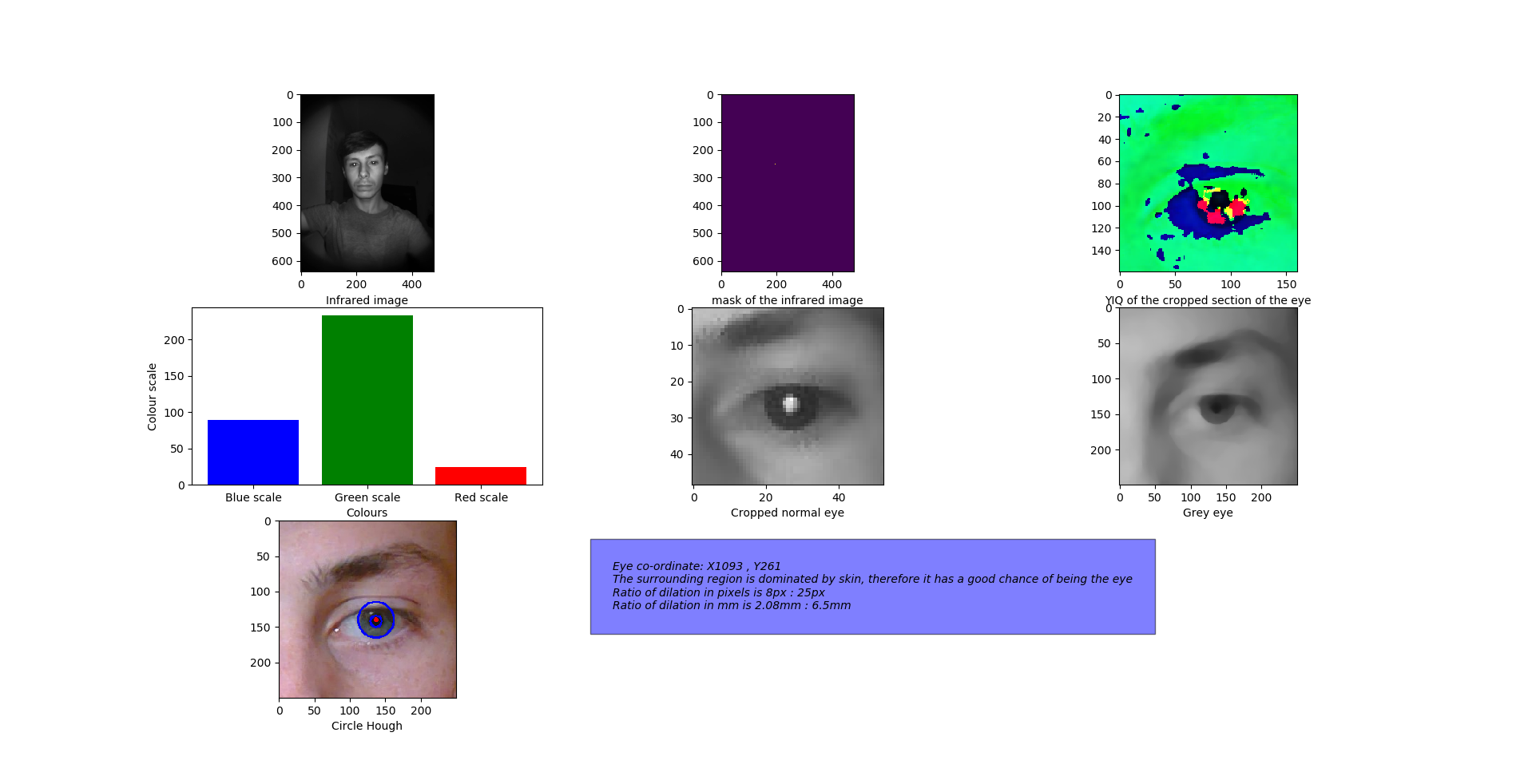 Pupil-Dilation-Measurement