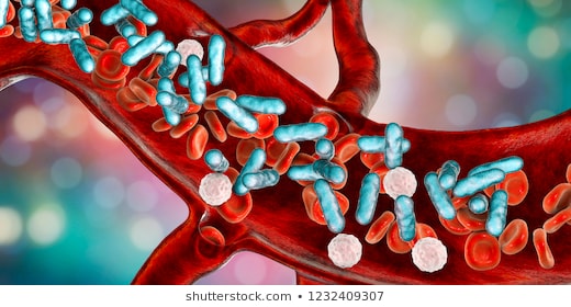 Comparing-6-Classifiers-for-Sepsis-Dataset