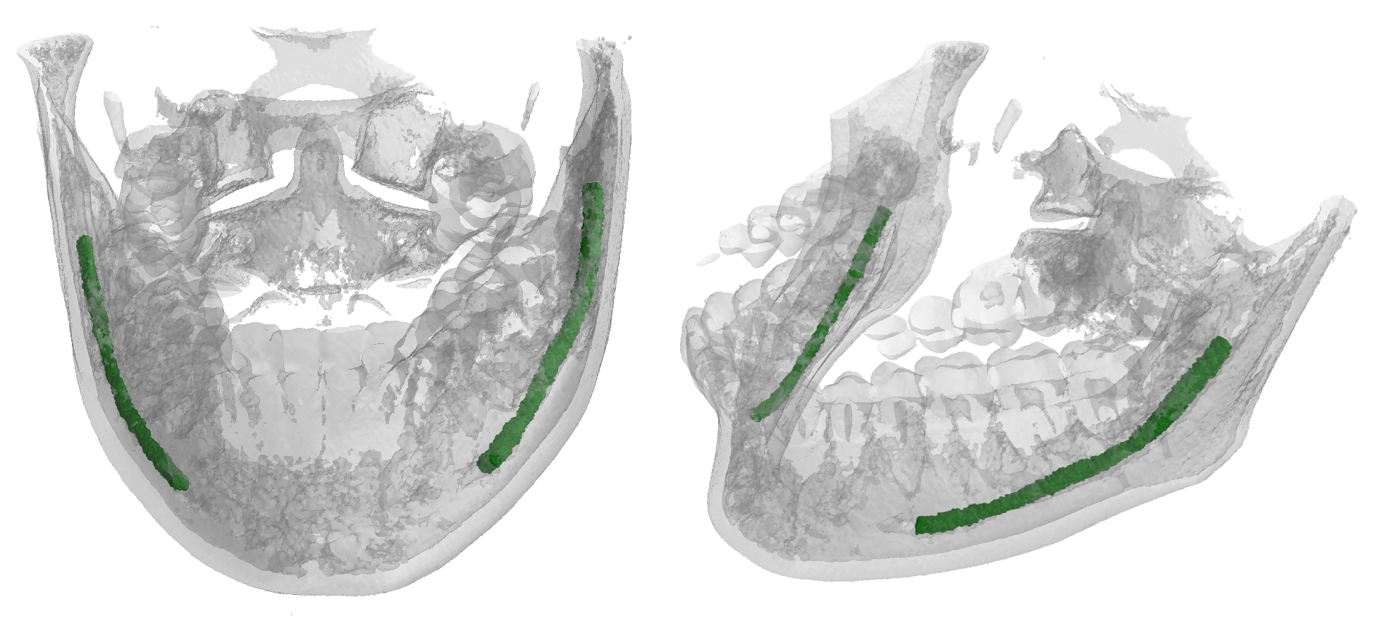 alveolar_canal