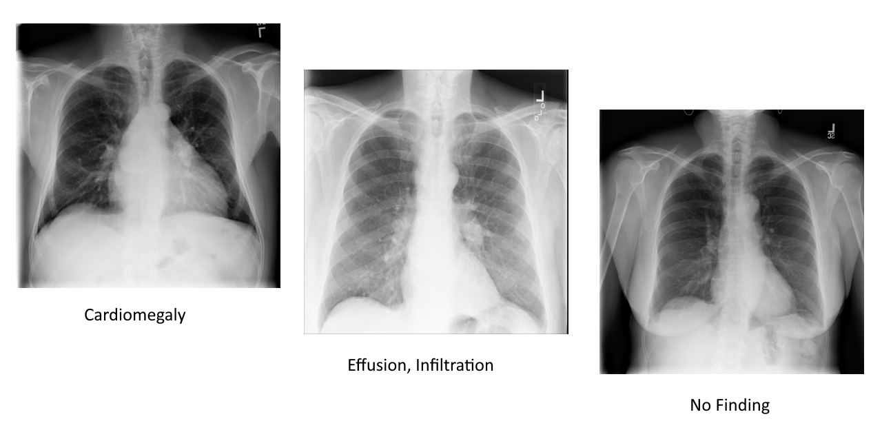 augmented-chest-xray