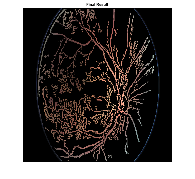 Diabetic-Retinopathy-by-eye-segmentation-with-eye-detection