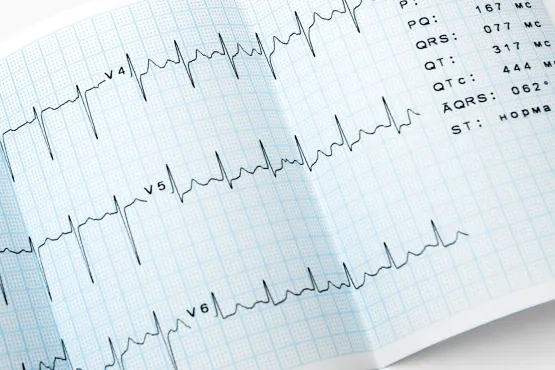 AI-Powered Interpretation of Electrocardiograms