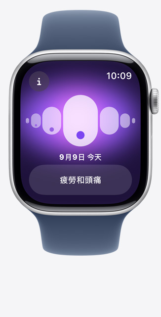 Apple Watch Series 10 上經期追蹤 app 的正面圖，顯示睡眠變化。