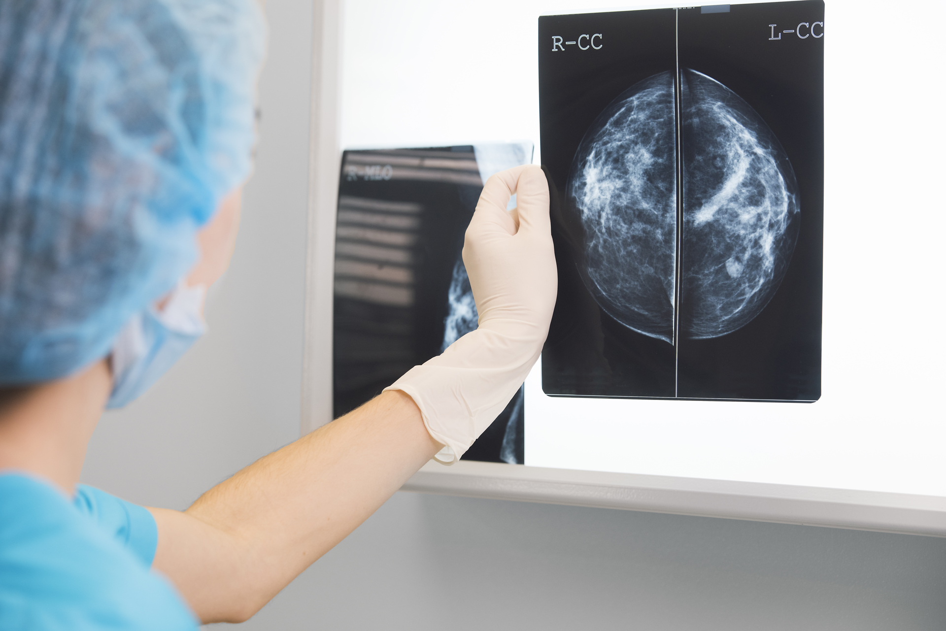 4 Things to Know about Breast Density