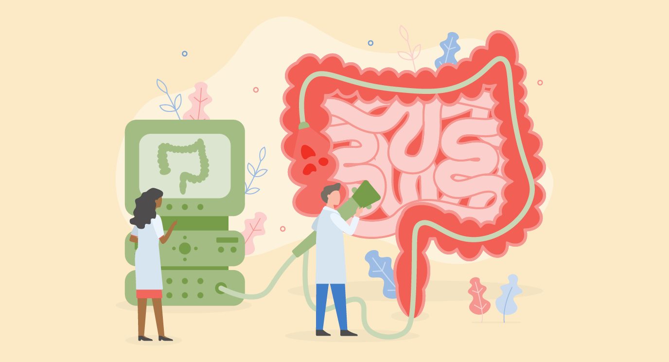 Colonoscopy illustration