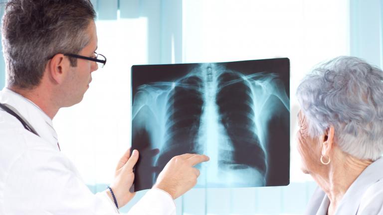 Medical professional showing x-ray of lungs to senior woman