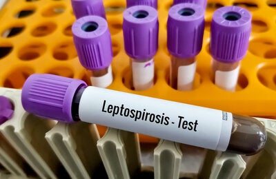 leptospirosis test