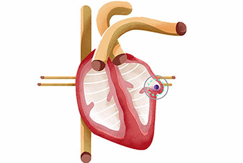 Watchman Heart Illo Alternative 350x235v1