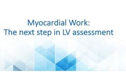 Webinar Replay: Myocardial Work